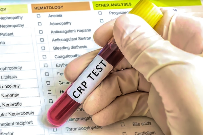 chefv-crp-blood-test-900p CRP test
